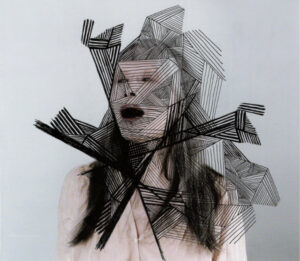 Epilepsy Is Dancing
