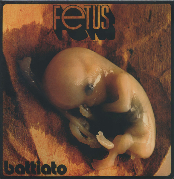 Foetus