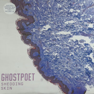 Shedding Skin: imagen 1